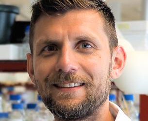 Untersuchung von Mitochondrien und Lysosomen bei BPAN